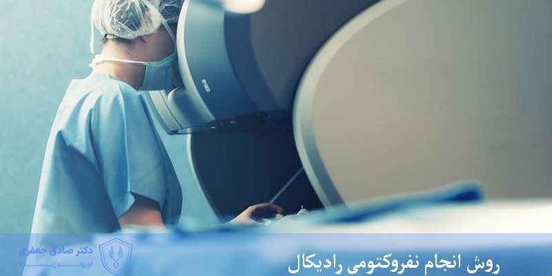 روش انجام نفروکتومی رادیکال