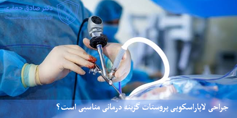 جراحی لاپاراسکوپی پروستات گزینه درمانی مناسبی است؟