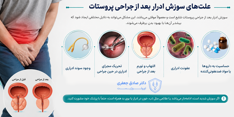 دلایل سوزش ادرار بعد از جراحی پروستات