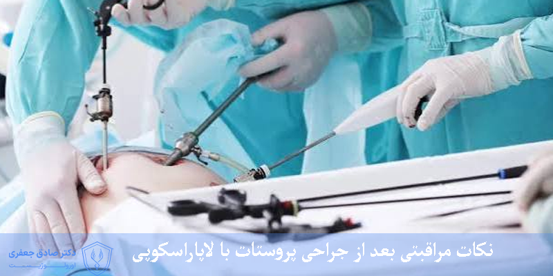 نکات مراقبتی بعد از جراحی پروستات با لاپاراسکوپی