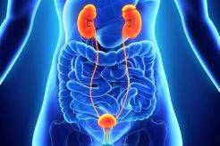 Vesicoureteral reflux